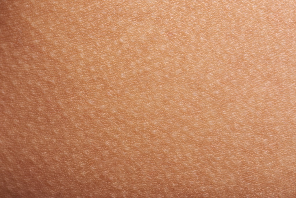 bumps on skin