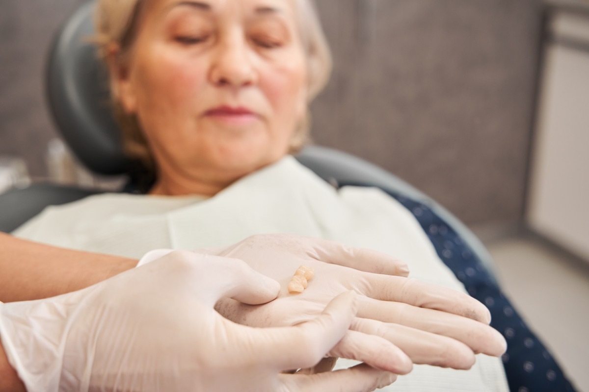 Cropped view of the female dentist holding tooth after extraction. Hand of doctor with loose tooth. Dentistry concept. Woman looking at her miss teeth. Focus at the tooth. Stock photo