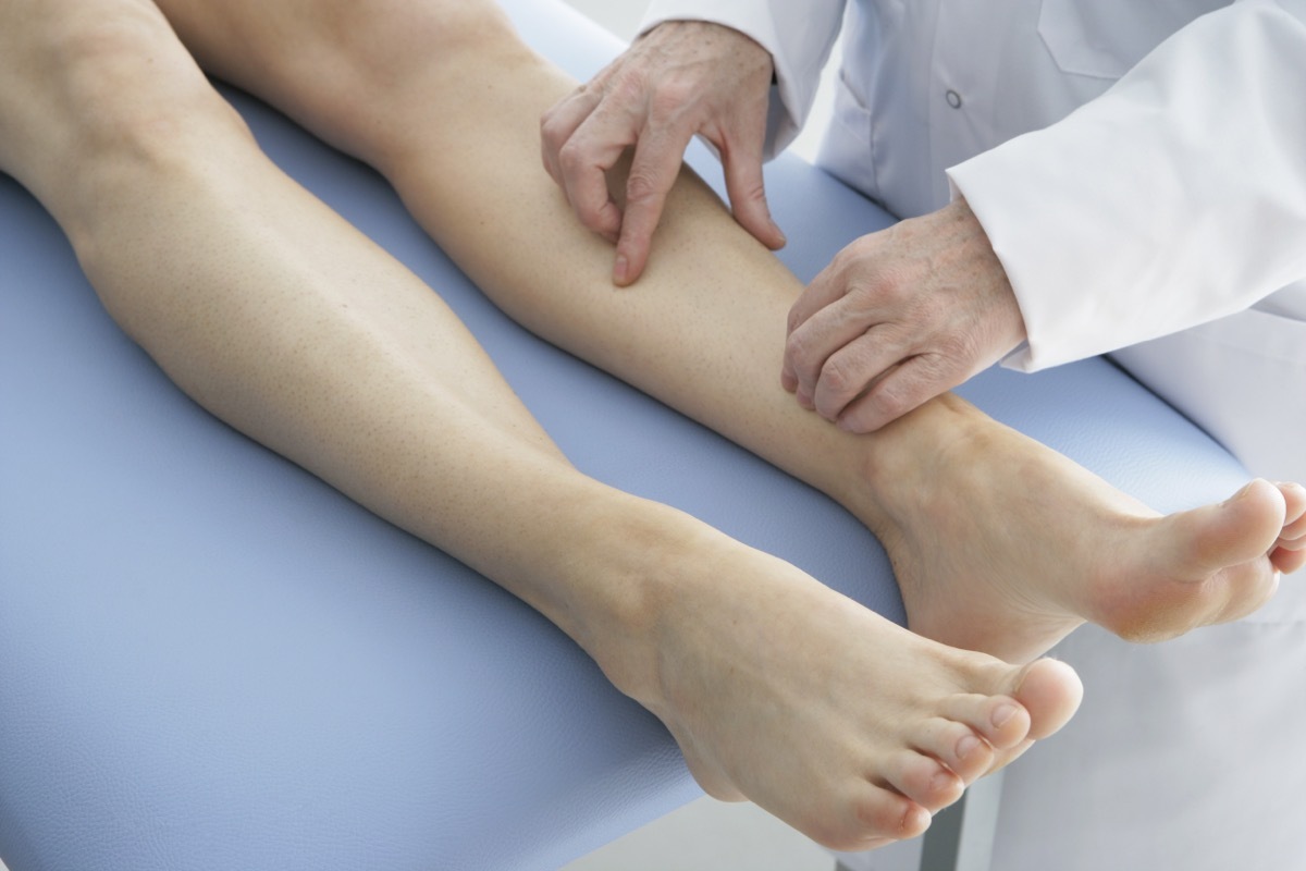 doctor examining patient's legs on table