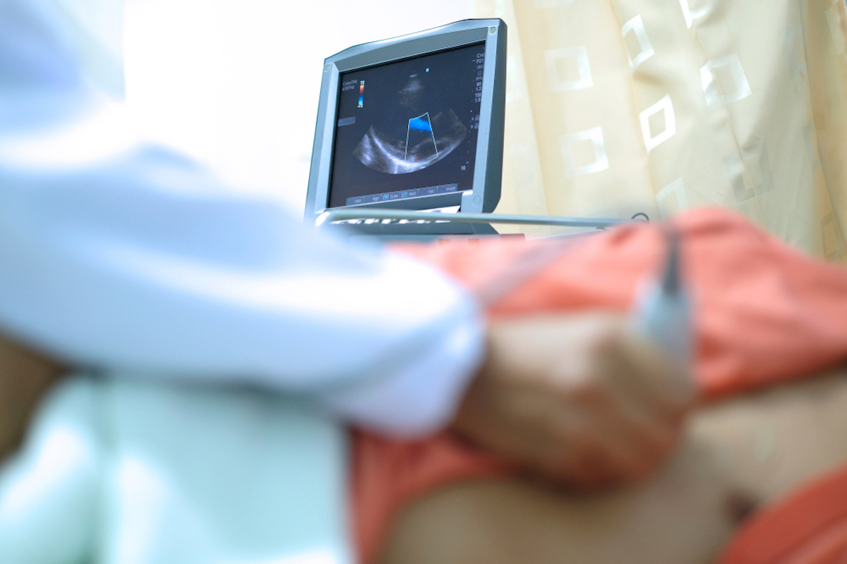 closeup of doctor doing echocardiogram