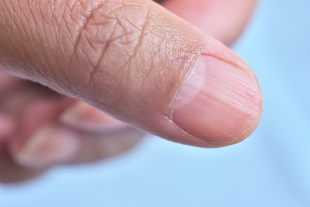 lunule on fingernail names of everyday items