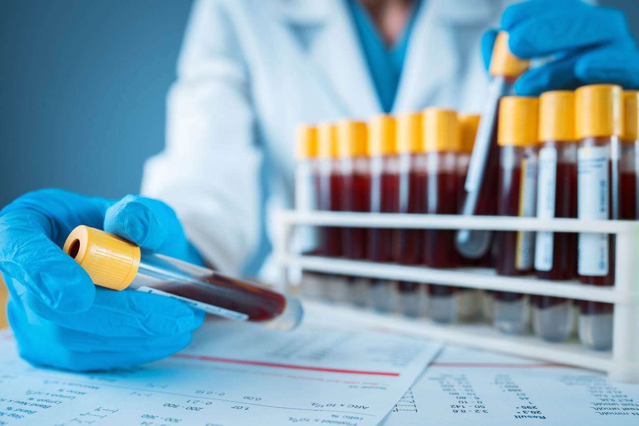 The gloved hand of a lab technician holding a vial of blood in front of a rack of other blood samples.